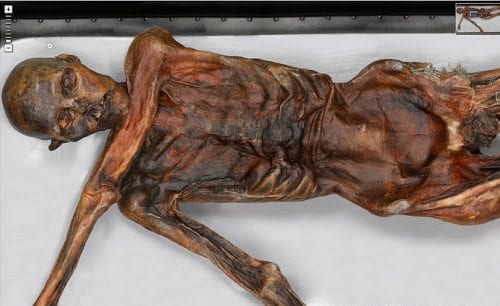 La decolorazione di crema da lentiggini del corpo