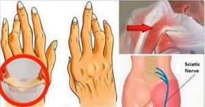 Ecco come combattere il mal di schiena, la sciatica e l?artrite con l?olio di ricino