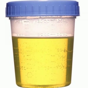 urina-sterile-300x300.jpg