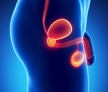 Sintomi cancro alla prostata Sintomi cancro alla prostata