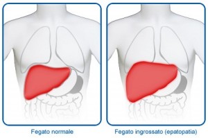 Fegato Ingrossato Perché Ne Possiamo Soffrire E Come Si