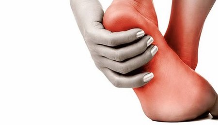 Fascite plantare, un’infiammazione che provoca dolore: quali sono i sintomi e quanto dura