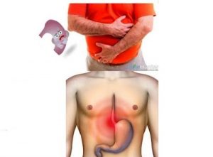 cancro allo stomaco cancro allo stomaco