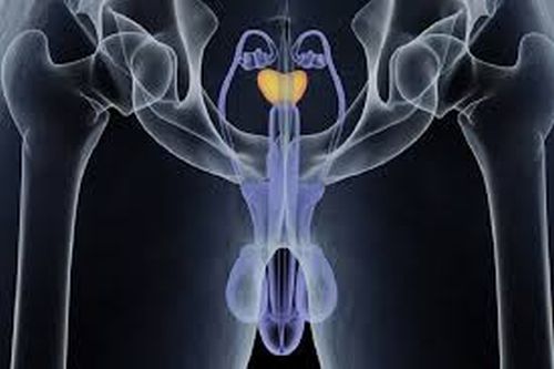 Tumore alla prostata, ecco i sintomi da non sottovalutare e cosa fare Tumore alla prostata, ecco i sintomi da non sottovalutare e cosa fare