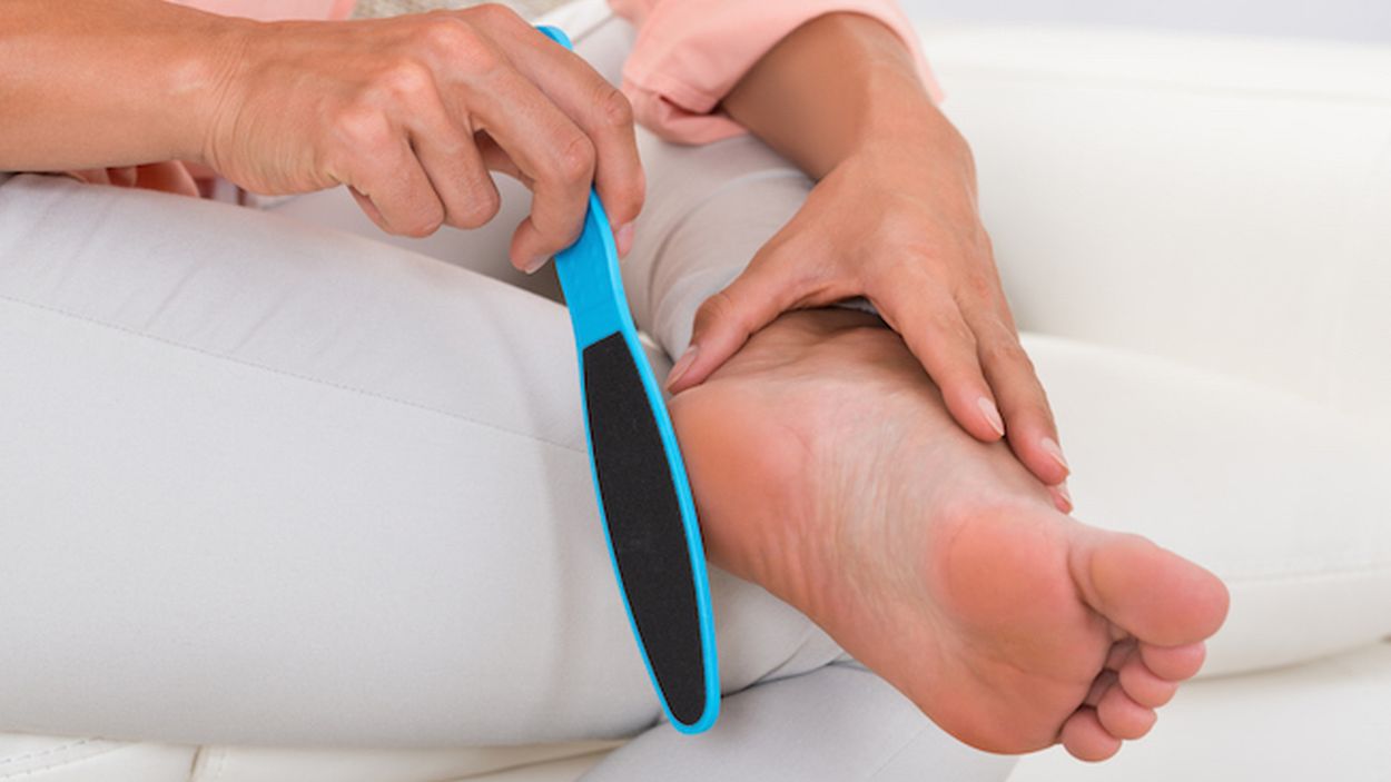 Calli E Duroni Soffrite Di Questi Problemi Ecco Cosa Fare E Come Prevenirli