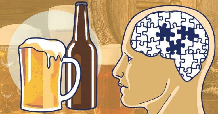 Alzheimer: ecco come la birra può aiutare nella malattia