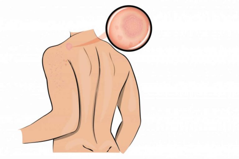 7 segnali importanti che indicano che il tuo corpo è molto stressato 7 segnali importanti che indicano che il tuo corpo è molto stressato