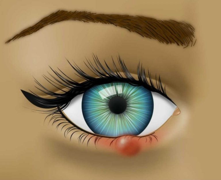 Gli occhi ti stanno avvisando sul tuo stato di salute: ecco i segnali d’allarme che devono preoccuparti