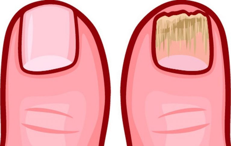 Importante: se il tuo corpo in questo momento è infestato di tossine, compariranno tutti questi sintomi. La lista Importante: se il tuo corpo in questo momento è infestato di tossine, compariranno tutti questi sintomi. La lista