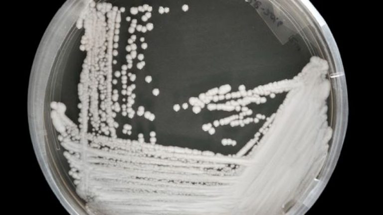 Il ‘Superfungo’ mortale Candida Auris ha ormai raggiunto 32 paesi: è allarme mondiale
