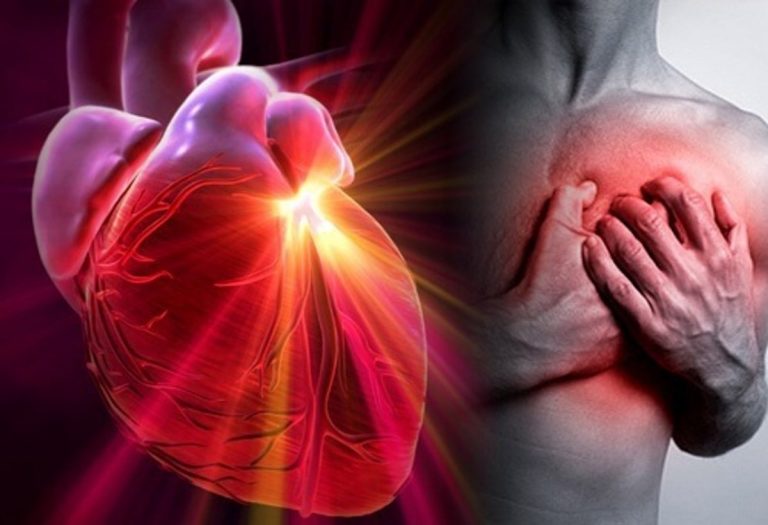 Attacco cardiaco, questi 5 sintomi non vanno sottovalutati: ecco come riconoscere in tempo un infarto