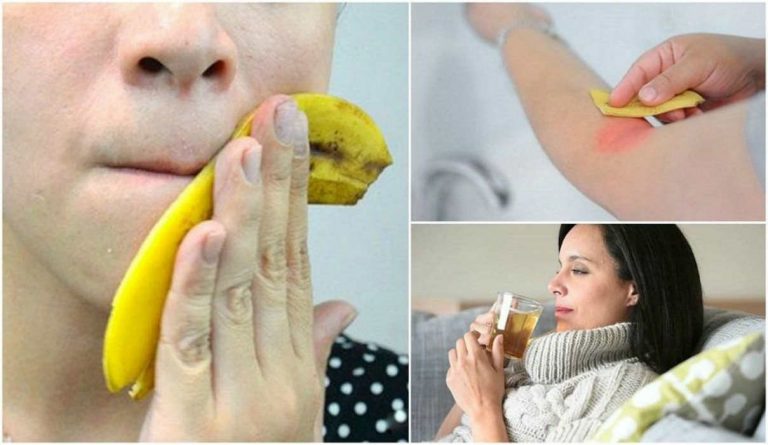 Le bucce di banana hanno degli straordinari effetti benefici: ecco come combattono molti disturbi