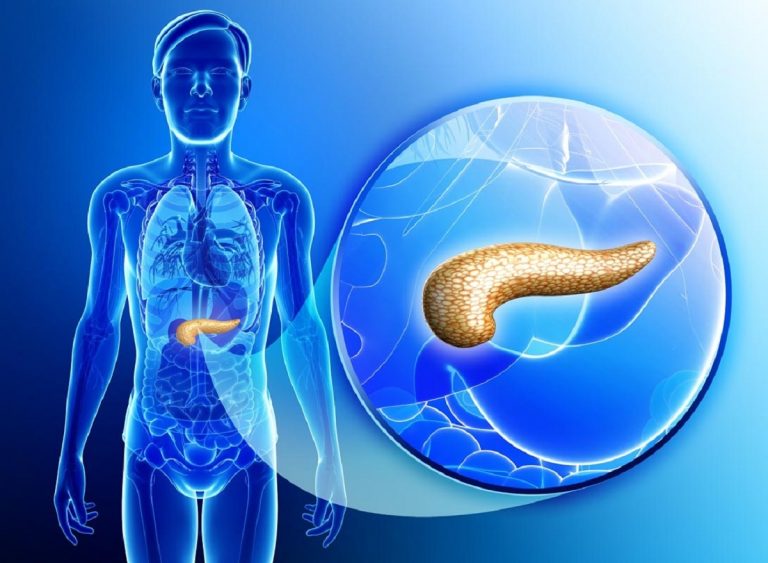 Il tumore al pancreas ha dei sintomi silenziosi: ecco cosa fare per ridurre i rischi