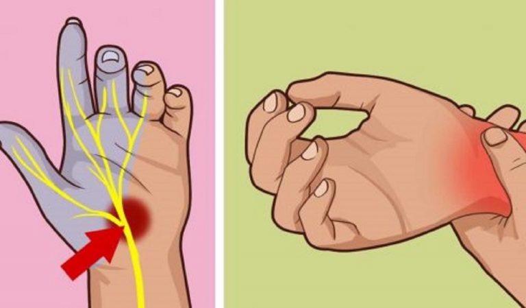 Hai questi sintomi? Stai soffrendo della sindrome del tunnel carpale. Ecco come riconoscerla subito