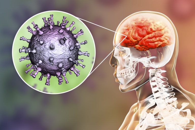 Se stai avendo questi sintomi di meningite devi subito allarmarti. Ecco come riconoscerli