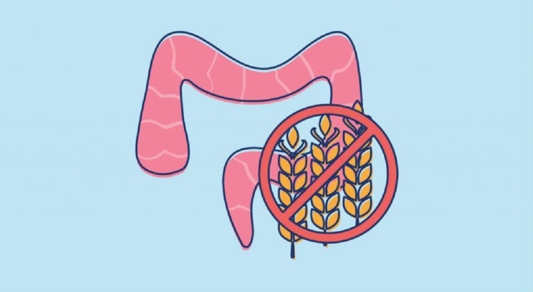 Celiachia, se stai avendo questi sintomi atipici potresti essere intollerante al glutine Celiachia, se stai avendo questi sintomi atipici potresti essere intollerante al glutine
