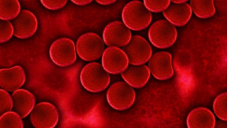 Leucemia, attenzione a questo sintomo che si presenta di notte Leucemia, attenzione a questo sintomo che si presenta di notte