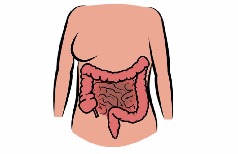 Tumore al colon, questo segnale nascosto ti consente di riconoscerlo in anticipo