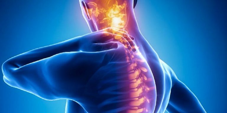 Cervicale, ecco qual è il sintomo che non bisogna ignorare. Come prevenirla Cervicale, ecco qual è il sintomo che non bisogna ignorare. Come prevenirla