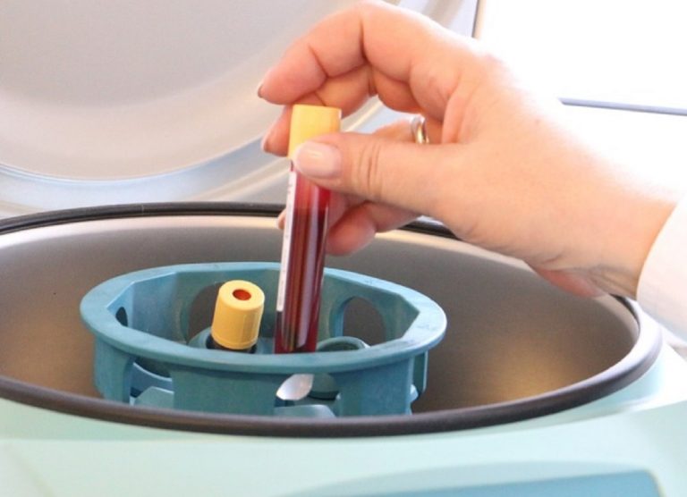 Colesterolo alto? Adesso potrai beneficiare dell’esenzione dal ticket sanitario e avere cure gratis: ecco in quali casi Colesterolo alto? Adesso potrai beneficiare dell’esenzione dal ticket sanitario e avere cure gratis: ecco in quali casi