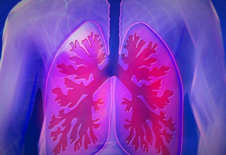 Tumore al polmone, gli scienziati hanno scoperto perché si ammalano anche i non fumatori