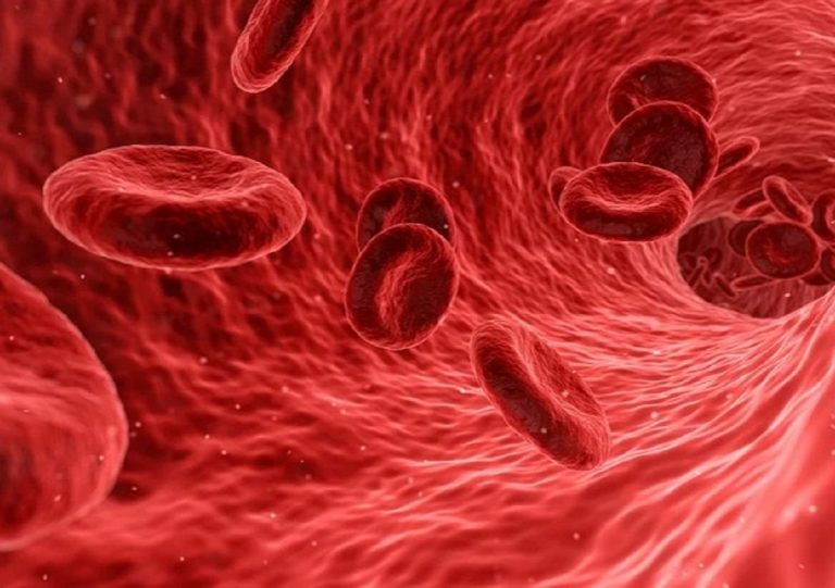 Un semplice controllo del sangue potrebbe aiutare a identificare una malattia delle arterie e a ridurre il rischio di ictus e infarto