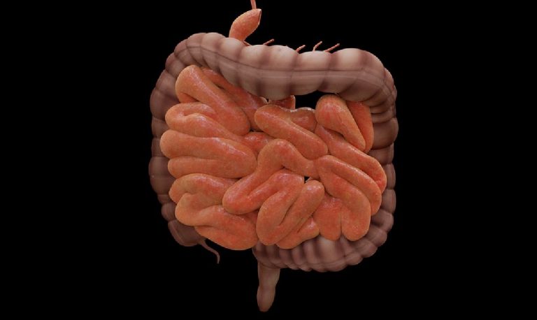 Disbiosi intestinale, cos’è? I sintomi, le cause e la cura | Alimenti consigliati e da evitare
