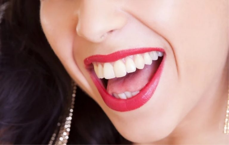 Macchie gialle sui denti? Ecco da cosa nascono e come rimuoverle