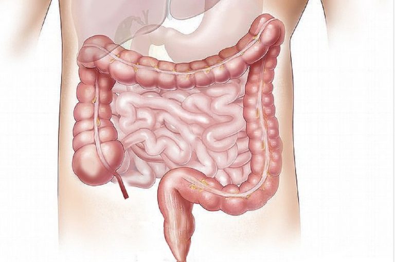 Sindrome del colon irritabile, il dottor Fausto Lella spiega quali sono i sintomi tipici Sindrome del colon irritabile, il dottor Fausto Lella spiega quali sono i sintomi tipici