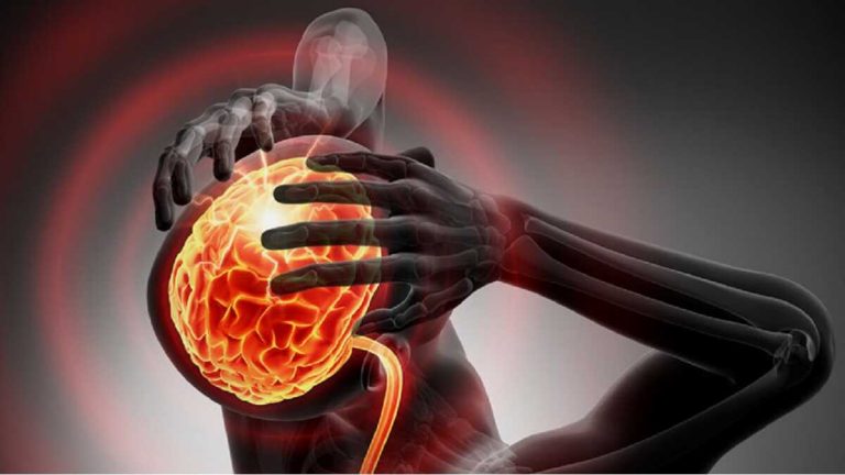 Manipolazioni del collo e ictus, c’è davvero una correlazione? Ecco cosa dicono gli scienziati Manipolazioni del collo e ictus, c’è davvero una correlazione? Ecco cosa dicono gli scienziati
