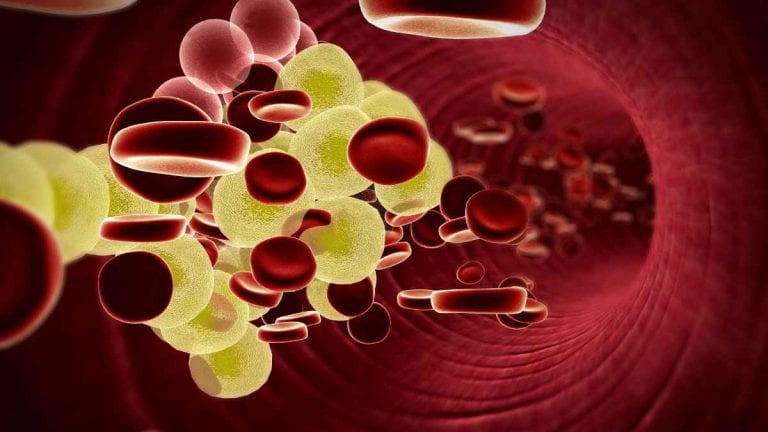 Colesterolo alto, nuova scoperta dei ricercatori italiani: mangiare in fretta raddoppia il rischio Colesterolo alto, nuova scoperta dei ricercatori italiani: mangiare in fretta raddoppia il rischio