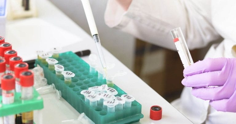 Anticorpi Coronavirus scoperti da scienziati in pangolini e pipistrelli della Thailandia Anticorpi Coronavirus scoperti da scienziati in pangolini e pipistrelli della Thailandia