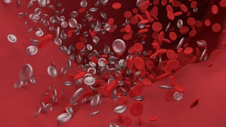 Trombosi venosa profonda, ecco quali sono i sintomi da non sottovalutare, le possibili cause e come prevenirla