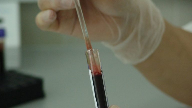 Covid-19, la predisposizione a contrarre forme gravi della malattia può dipendere da mutazioni genetiche Covid-19, la predisposizione a contrarre forme gravi della malattia può dipendere da mutazioni genetiche