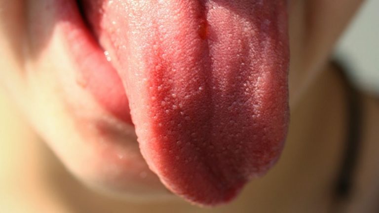 Pulire la lingua è molto importante: ecco i clamorosi benefici e come farlo