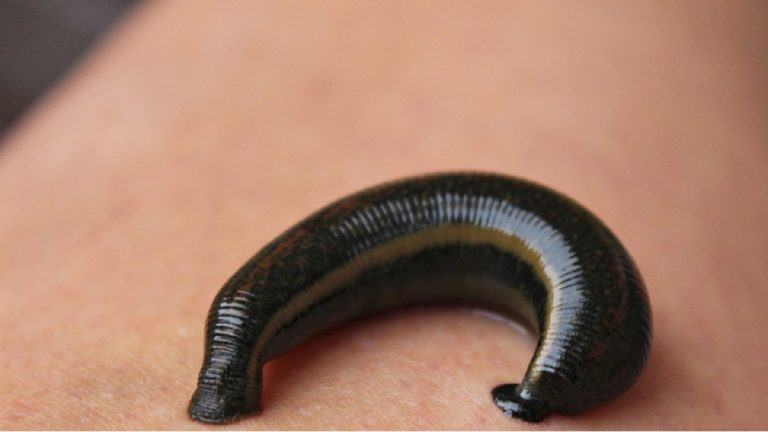 Bambino ricoverato per tosse sospetta, la causa era un sanguisuga di 8 centimetri: l’incredibile scoperta dei medici Bambino ricoverato per tosse sospetta, la causa era un sanguisuga di 8 centimetri: l’incredibile scoperta dei medici