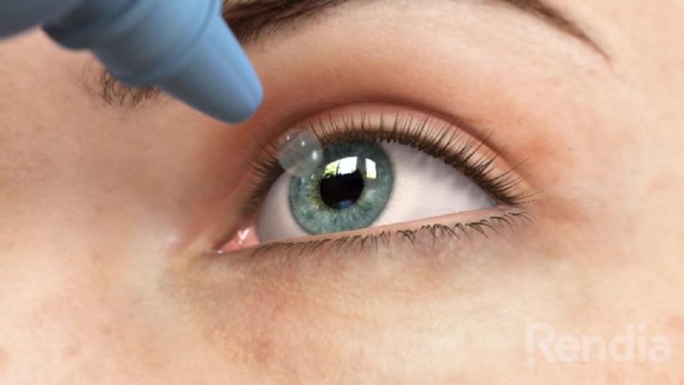 Addio agli occhiali da lettura, arriva il collirio che garantisce una buona vista anche da vicino: ecco come si usa