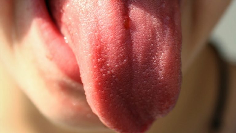 Ecco i segnali sulla lingua che possono indicare il tuo stato di salute Ecco i segnali sulla lingua che possono indicare il tuo stato di salute