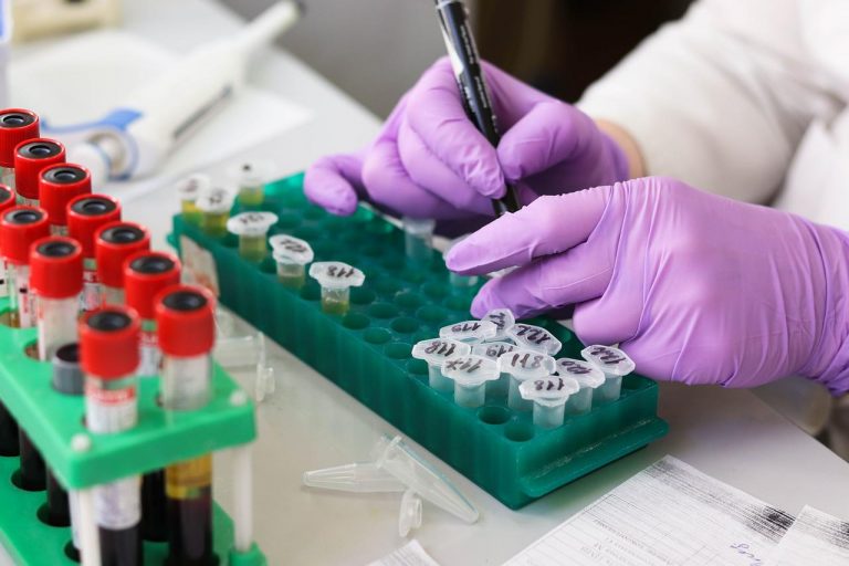 Epatite acuta nei bambini, scoperta la causa? Ecco cosa indicano due studi Epatite acuta nei bambini, scoperta la causa? Ecco cosa indicano due studi