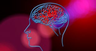 ictus