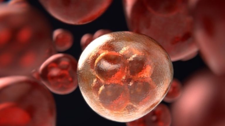 Tumore precoce, aumentano i casi negli under 50, i possibili fattori di rischio