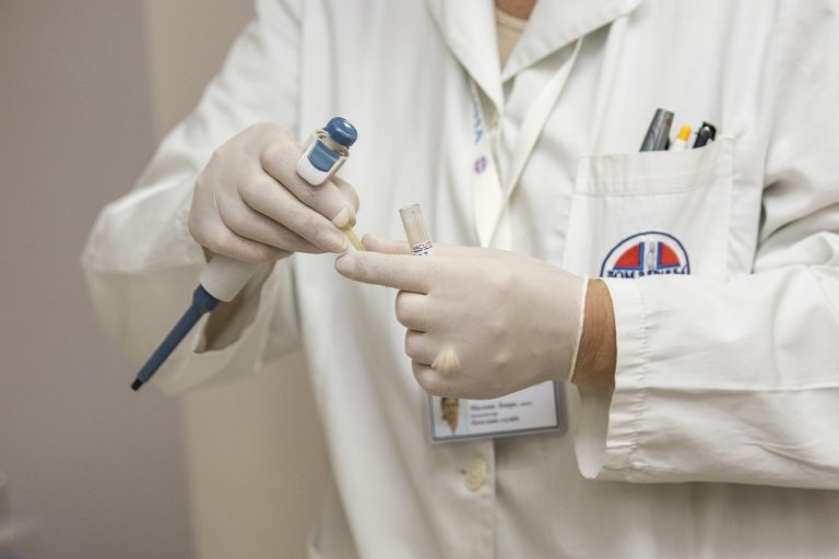 Diversi casi in Italia in pochi giorni, scatta l’allarme per il morso del ragno violino: ecco come comportarsi Diversi casi in Italia in pochi giorni, scatta l’allarme per il morso del ragno violino: ecco come comportarsi