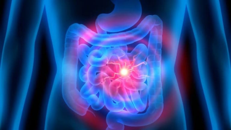 Infarto intestinale, ecco come riconoscerlo in tempo: i sintomi ai quali prestare attenzione