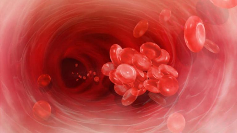 Coaguli nel sangue, attenzione a questi segnali che non vanno ignorati Coaguli nel sangue, attenzione a questi segnali che non vanno ignorati