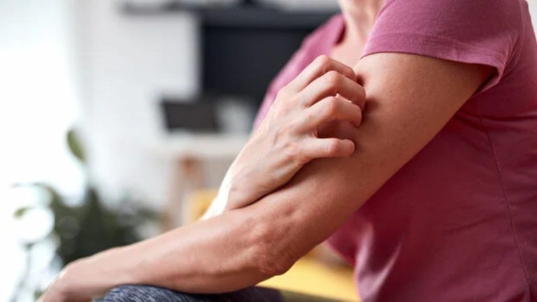 Attenzione al prurito: questo sintomo spesso sottovalutato può indicare la presenza di alcuni tipi di tumori