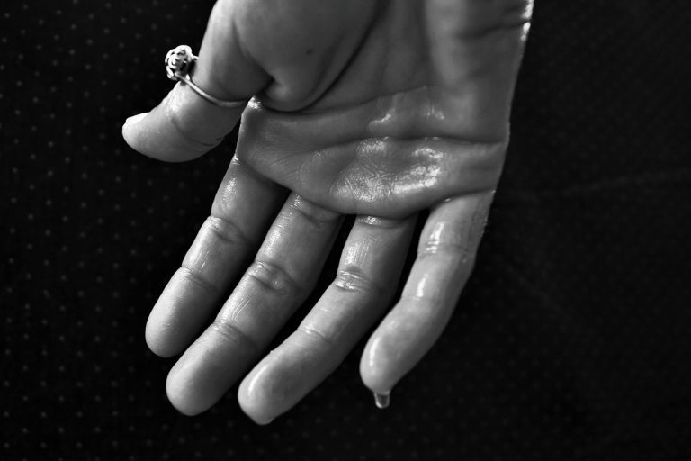 Mani sudate, ecco cosa potrebbe nascondere un’eccessiva sudorazione e quali sono i rimedi Mani sudate, ecco cosa potrebbe nascondere un’eccessiva sudorazione e quali sono i rimedi
