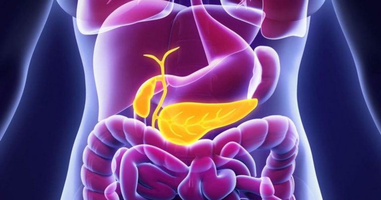 Tumore del pancreas: questi due segnali tipici possono indicarne la presenza due o tre anni prima della diagnosi ufficiale