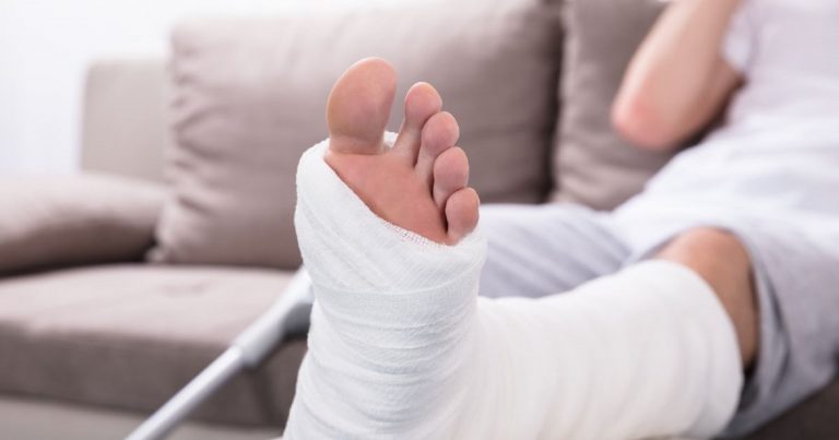 Frattura alle ossa, ecco i comportamenti da adottare per recuperare in