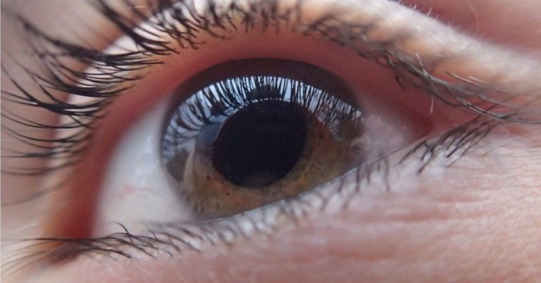 Cornea, i sintomi della cheratite: ecco come riconoscerla e le possibili cause