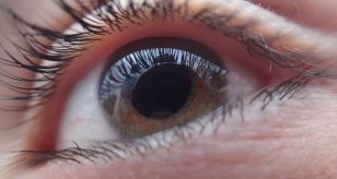 Cornea